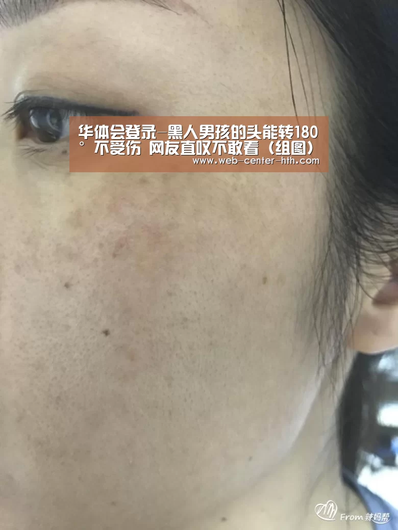 华体会登录-黑人男孩的头能转180°不受伤 网友直叹不敢看(组图)(图3) 华体会