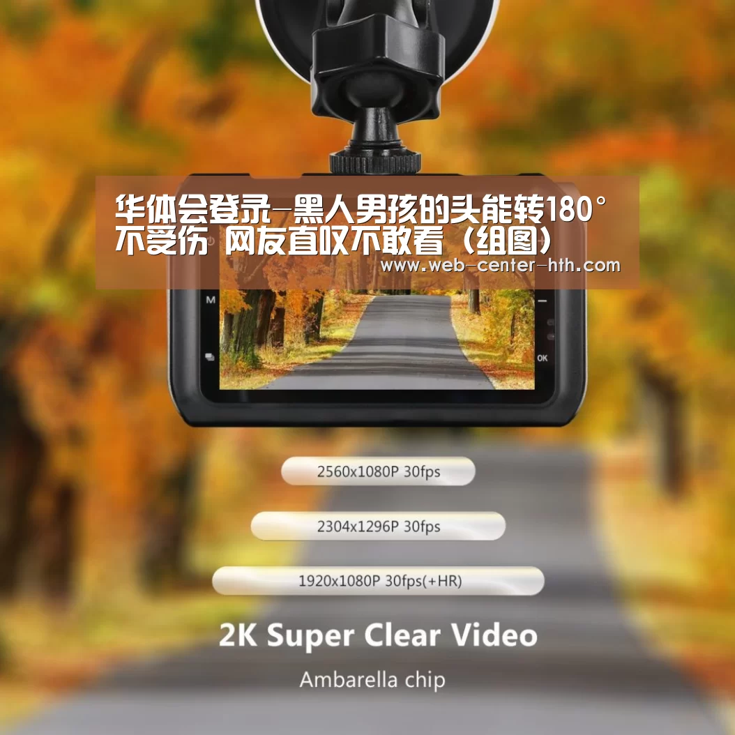 华体会登录-黑人男孩的头能转180°不受伤 网友直叹不敢看(组图)(图2) 华体会官网